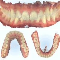 anomalia-dentofacial-clase-1.jpg