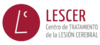 8b47b5cd5ee3-lescer-logo-Photoroom.png