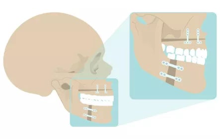 Master en dentisterie pédiatrique | UAX