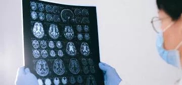 Master of Lifelong Learning in Central Nervous System Radiosurgery
