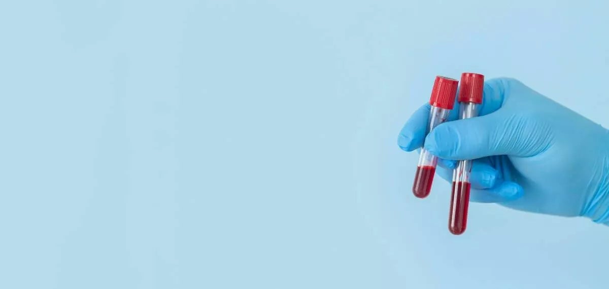 Corso FP online in laboratorio clinico e biomedico in Spagna | UAX